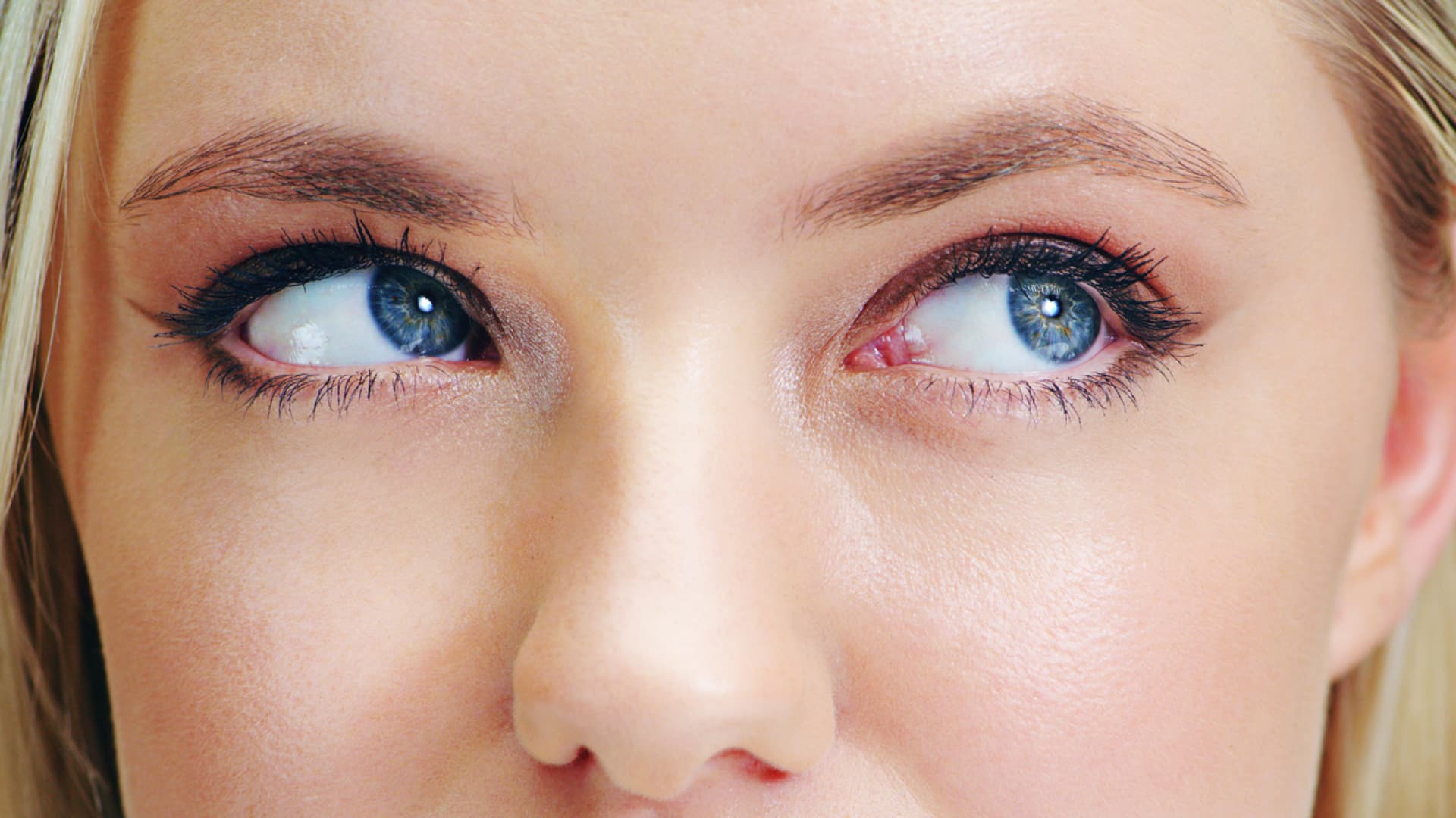 Stress, Sleep & Magnesium: Deciphering Your Eyelid Twitch Causes